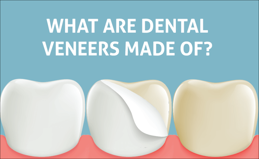 What dental veneers are made of